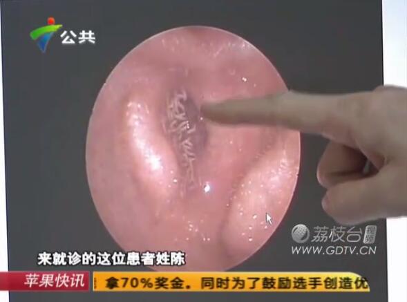 �@�������Ӷ���(n��i)�L(zh��ng)�M��ɫ���x(ch��ng)��˺ҧ����ʹ��������