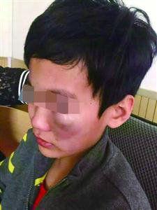 С�W(xu��)�����n���ώ����� �ώ�:�����R������(�D)