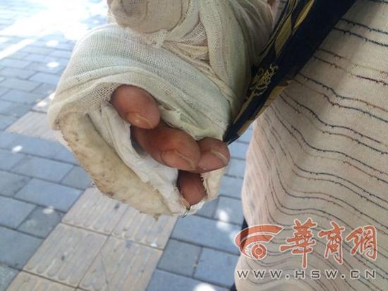 �Ύ�����5�³��ڵ��P�h��ӭ�e����ɻ�r(sh��)�܂�������(d��ng)����ؓ(f��)؟(z��)���b·�ϵ�ˮ�������܇(ch��)�����ӵ�����(l��i)�r(sh��)������������ץ���������A(y��)�O(sh��)�õ�λ���������֪��ε�܇(ch��)�͵ض���һ���������S֮һ�����Ύ������ִ�Ĵָ��СĴָͬ�r(sh��)���A�ڃɸ��������g����(d��ng)��(ch��ng)������