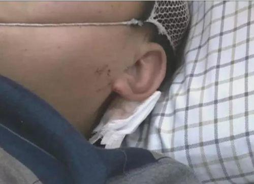 �����һ�𱻴����߀��������߅�����ϵ��ܴ������(j��ng)�^�t(y��)�������Д����ܴ�����~��Ƥ��ܛ�M�����[Û��һֱ���ڻ��Ԡ�B(t��i)��Ŀǰ߀�]�ж��^Σ�U����